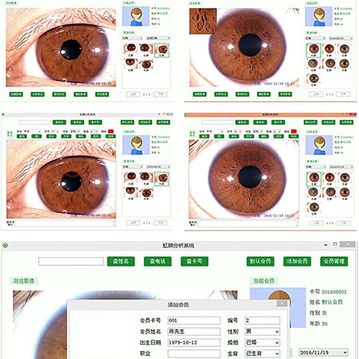 New 5.0 MP USB Iriscope Iris Detector with Pro Iris Software Eye Iriscope Iris Analyzer Analysis Iridology Camera for Beauty Salons, Personal Health Management Centers