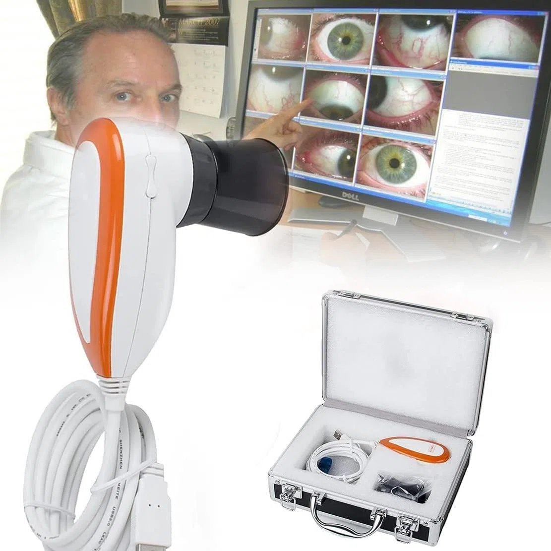 Caméra d'analyse d'iris 5,0 MP, caméra d'iridologie pour analyseur d'iris, analyseur de Lampe USB Gauche/Droite/avec Logiciel d'iris, Haute résolution 2560 x 1920